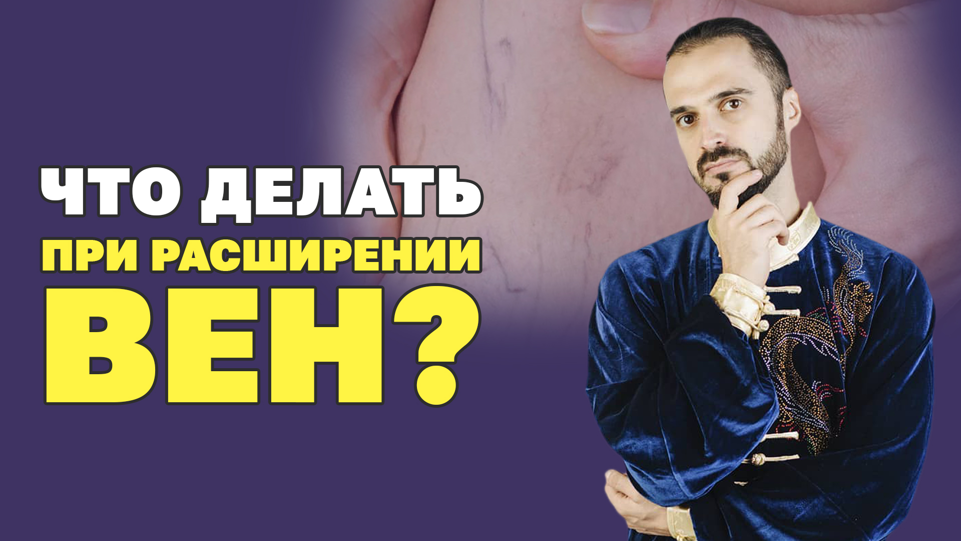 Варикозное и геморроидальное расширение вен! Причины и что делать? Упражнения против варикоза!