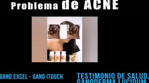 ¿ACNÉ? MIRA ESTO, ? Testimonio de Salud con Ganoderma Lucidum.