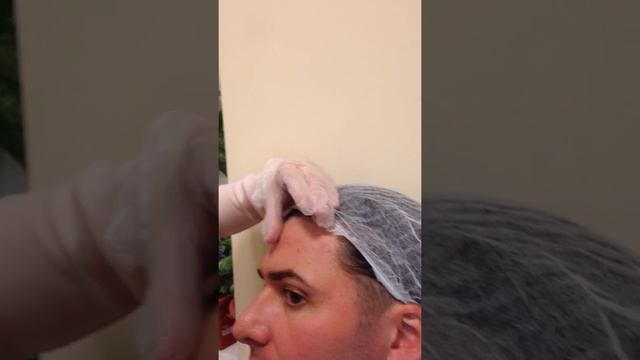 Ботокс обучение практика студента смотреть онлайн