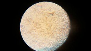 Эритроциты. Микроскоп Аналит 900-х крат.