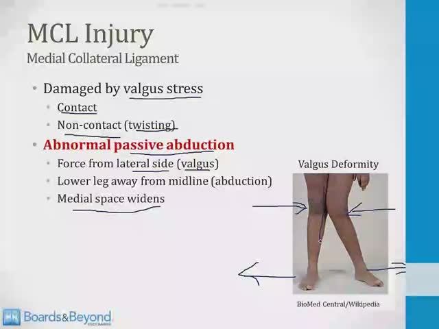 Опорно-двигательный аппарат USMLE - 1. Анатомия и ортопедия - 1.Колено