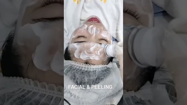missbelle Semarang facial & peeling #facialwajah #peelingwhitening #fillerhidung смотреть онлайн
