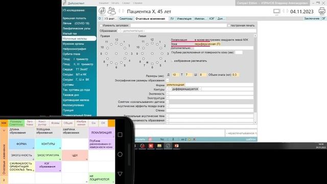 Кисты молочных желез. Как дифференцировать? Как описывать при помощи смартфона?