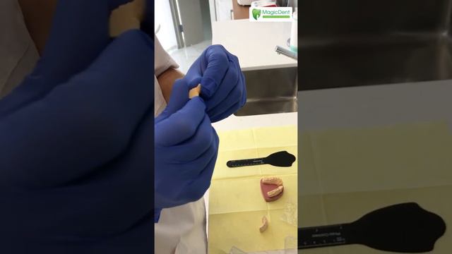 Высокоэстетичные керамические Виниры E-Max прямо из лаборатории. Часть 4 смотреть онлайн