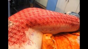 Татуировки, нанесённые методом шрамирования