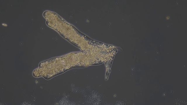 Amoeba proteus - Bewegungsstudie смотреть онлайн