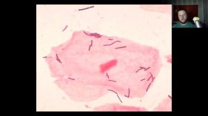 Введение в микробиологию. Часть 7. Систематика. Извитые, молочнокислые, споры