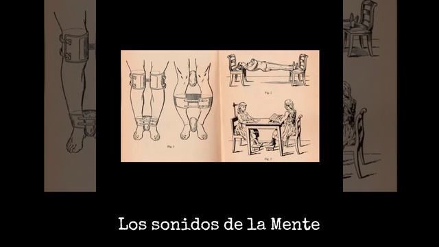 NBIe-BIG ELEPHANTS ANOMALOUS BAND-SCHREBER смотреть онлайн