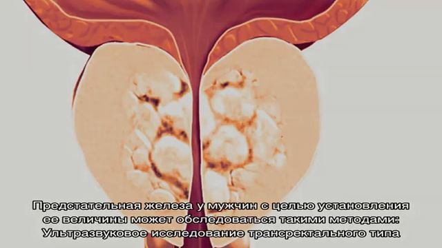 Описание предстательной железы – размеры: норма и причины отклонений