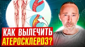 АТЕРОСКЛЕРОЗ: О ЧЁМ ВРАЧИ НЕ ГОВОРЯТ БОЛЬНЫМ?