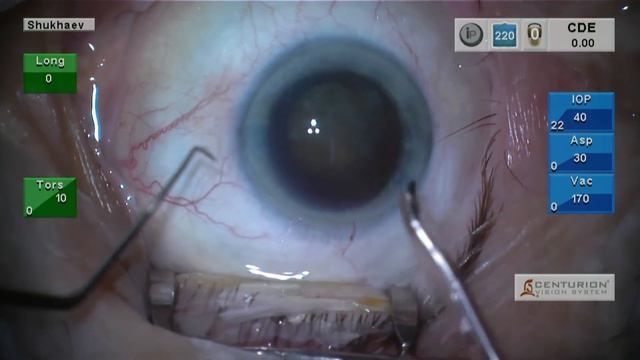 Conference on Ophthalmology! Санкт-Петербургский филиал МНТК "Микрохирургия глаза". смотреть онлайн