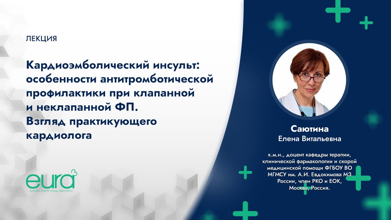 Кардиоэмболический инсульт: особенности антитромботического лечения. Взгляд практикующего кардиолога смотреть онлайн