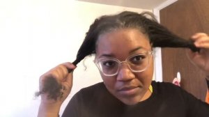 HUGE FLAKES!! *Close Up* Scratching Dandruff