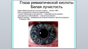 Иридодиагностика и индукторы ВБГ и ВШГ. С К Голиков