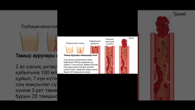 ЛУК ПИЯЗ ҚАБЫҒЫНЫҢ ПАЙДАСЫ.ТАМЫР АУЫРУЫҢЫЗҒА ЕМ.