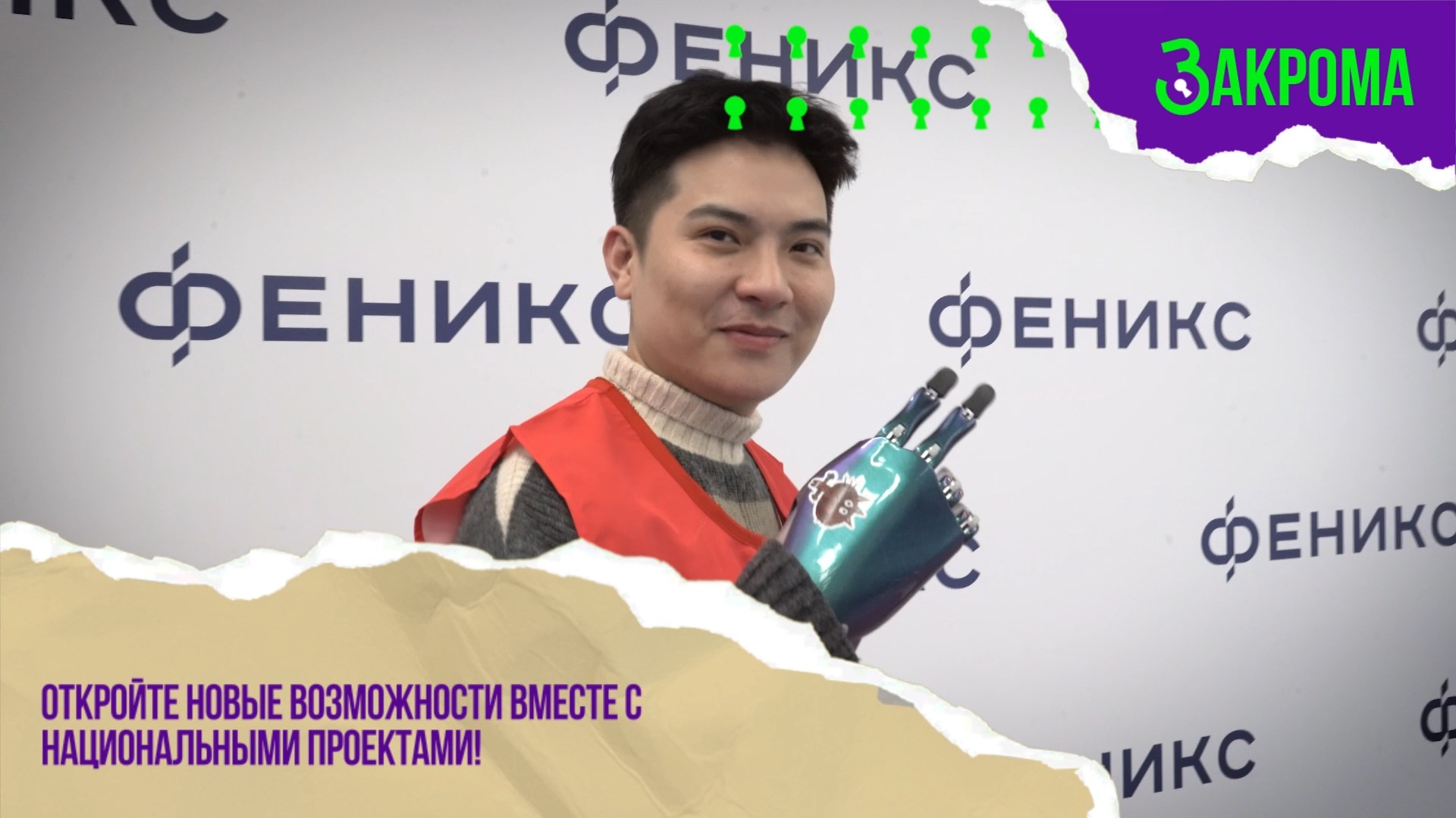 Бионические протезы: как создать производство с господдержкой