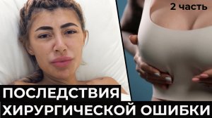 ТАТА История чужой хирургической ошибки и ее последствия. 2 часть. Блохин Сергей Николаевич.