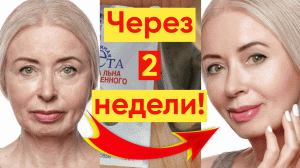 Как уменьшить морщины за 2 недели простая маска!