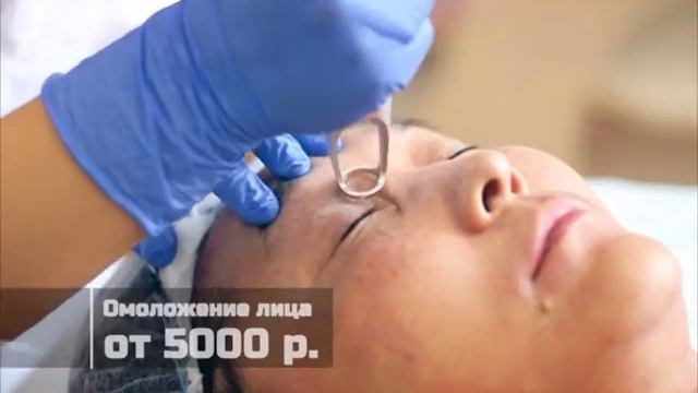 The Time: Фракционный фототермолиз смотреть онлайн