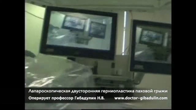 Лапароскопическая двусторонняя герниопластика паховой грыжи смотреть онлайн