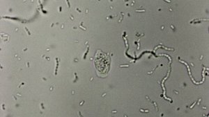 Молочная амеба и заросли Стрептококка термофильного