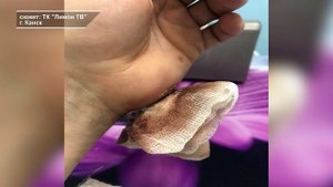 КОМПЕНСАЦИЯ ЗА УКУС СОБАКИ