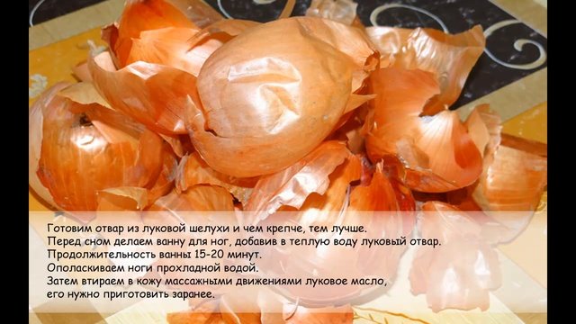 Варикозное расширение вен. Простой и действенный рецепт