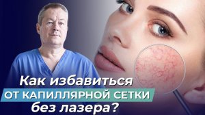 ЛУЧШИЙ МЕТОД избавиться ОТ СОСУДИСТЫХ ЗВЁЗДОЧЕК! Как вылечить капиллярные сетки на ногах без лазера?