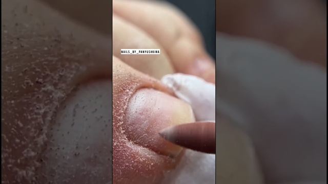 Полировка ногтей #аппаратныйпедикюр #ногти #педикюр #подология #подолог #дизайнногтей #вросшийногот смотреть онлайн
