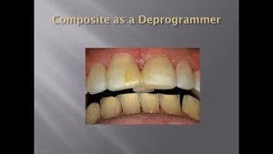 Kois Deprogrammer in Russian