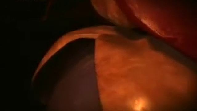 Тонкий кишечник (NG) смотреть онлайн