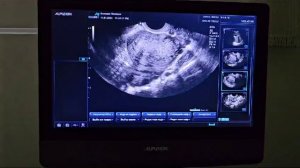 аппарат узи Ecube 7