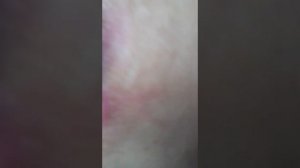 Обработка пролежней полная версия с перчатками 3-4 ст.и гигиеническими процедурами.