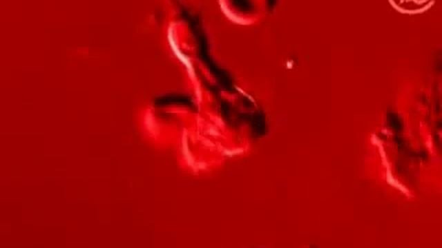 Кишечник   правда и мифы  Http   Www 1tv Ru Videoarchive 11322 )