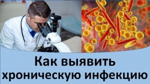 Как выявить хроническую инфекцию?