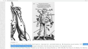 Biceps Pulley Anatomy on MRI