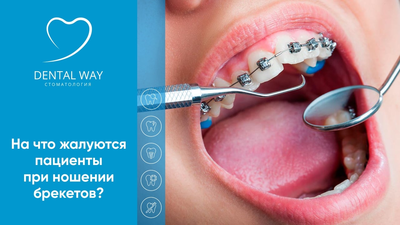 На что жалуются пациенты при ношении брекетов