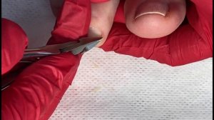 Аппаратный педикюр ? педикюр на себе ? обработка пальцев ног ? #педикюр