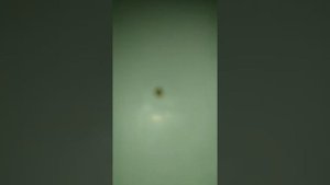 🈷️Камень из ПОЧЕК, Как Я вывел расскажу вам без боли, единственный вариант