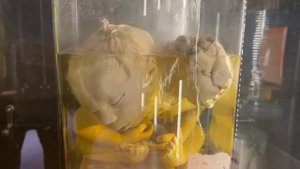 посетили музей аномалий тела.мутации,отклонения,дефекты,патологии, восковые фигуры,эмбрионы,чучела