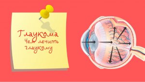 Глаукома | Чем лечить глаукому