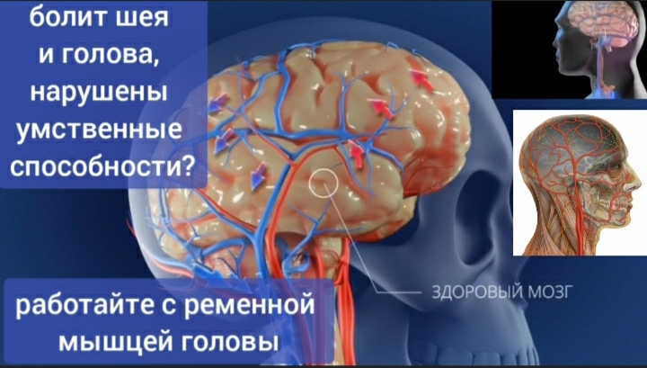 Кровь не может течь в шею и мозг из-за спазма ременной мышцы головы. Уникальные методы укрепления