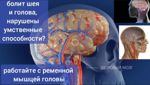 Кровь не может течь в шею и мозг из-за спазма ременной мышцы головы. Уникальные методы укрепления
