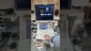 Toshiba Ultrasound machine Aplio 400 review