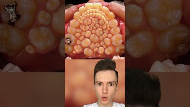 Ему удалили более 200 зубов #Shorts смотреть онлайн