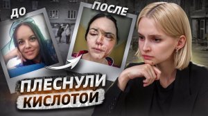 «Меня облили кислотой» | Кислотный маньяк из Монино