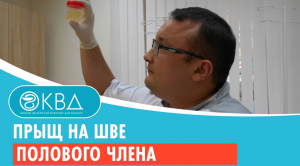 ? Прыщ на шве полового члена. Клинический случай №753