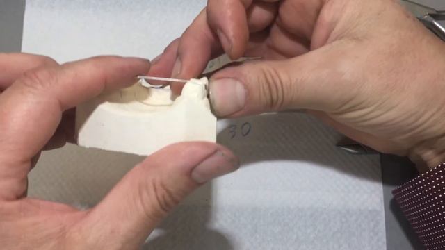 DENT 1015 Project 4 смотреть онлайн