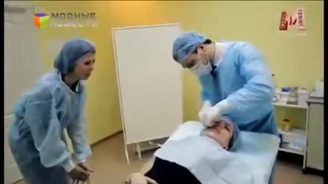 Нити APTOS   мгновенный лифтинг эффект, подтяжка и омоложение лица