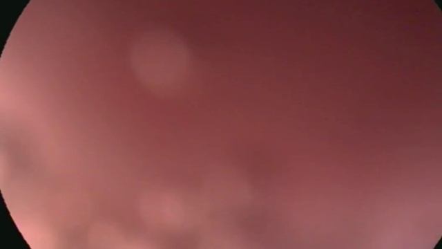 Инородный предмет в пищеводе у собаки смотреть онлайн